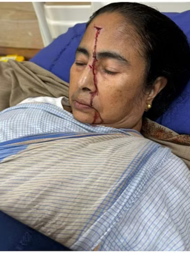 https://localnewsindia.com/mamata-banerjee-west-bengal-cm-major-injury